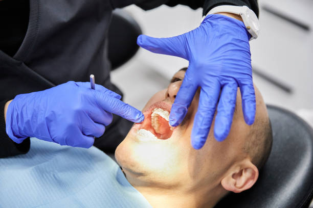Best Dental Abscess Treatment in Chepachet, RI