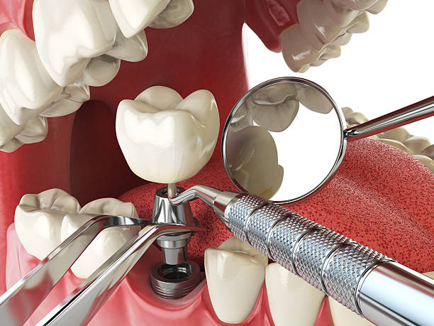 Best Emergency Cosmetic Dentistry (e.g., broken veneers) in Chepachet, RI